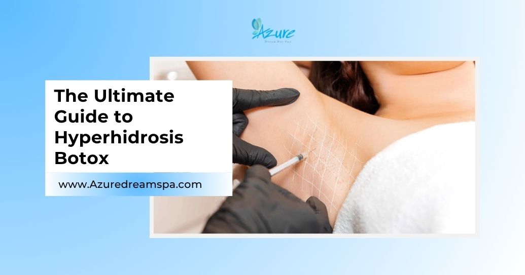 Close-up of a Botox for hyperhidrosis at Azure Dream MedSpa — featured image for “Botox for Hyperhidrosis” blog.