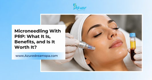 Microneedling With PRP: What It Is, Benefits, and Is It Worth It?