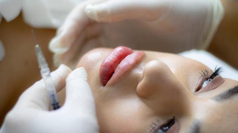How Long Does Dermal Filler Last? A Complete Guide to Filler Longevity and Whether Results Are Permanent