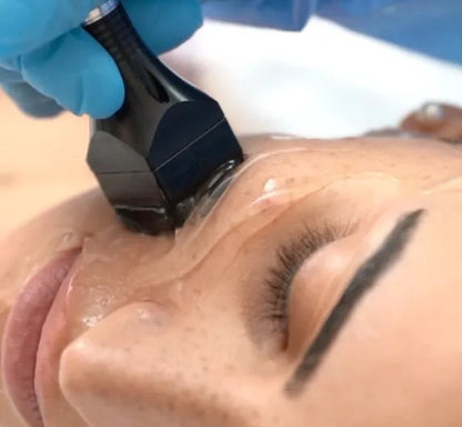 Forma Radiofrequency Skin Tightening