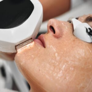 IPL - Intense Pulsed Light - Pkg 3